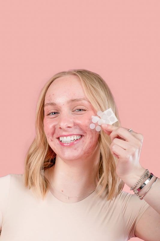 Dottie Refill Pack — 24 Hydrocolloid Pimple Patches